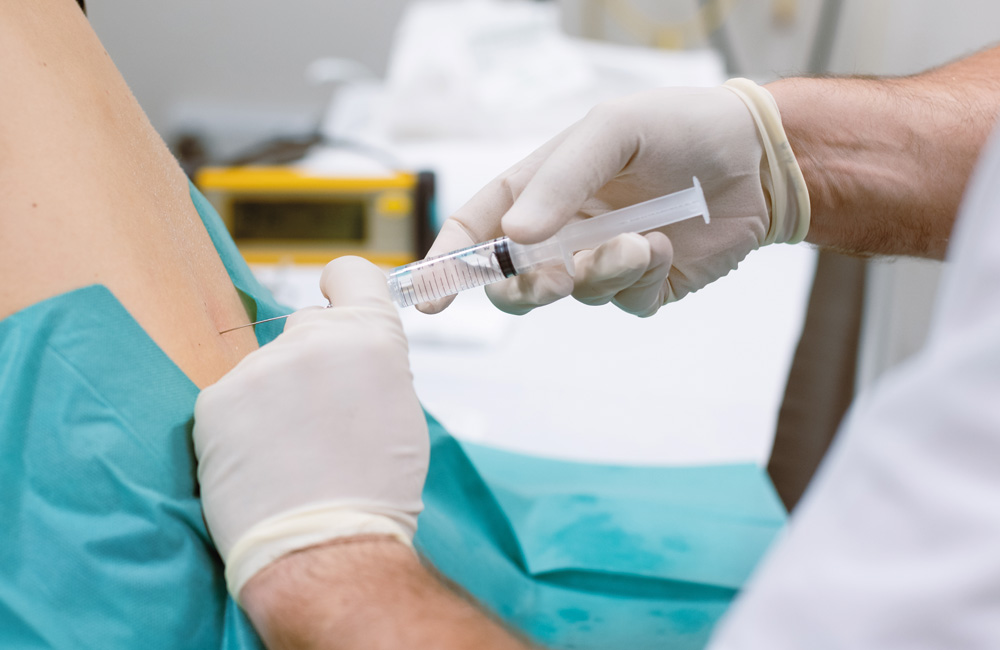 Injektionstherapie zur Behandlung von Bandscheibenschmerzen