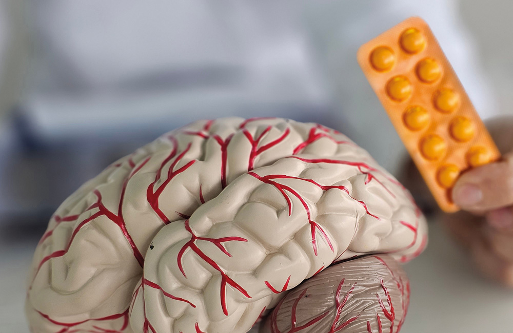 Gehirnmodell und Medikamente als Symbol für die Behandlung von Epilepsie