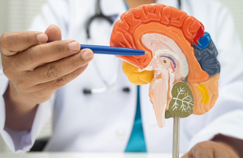 Arzt erklärt an einem Gehirnmodell mögliche Ursachen von Epilepsie