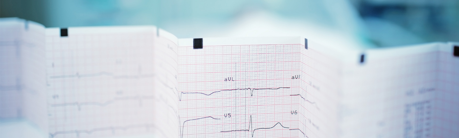 Nahaufnahme eines EKG-Ausdrucks mit Herzkurven auf Millimeterpapier