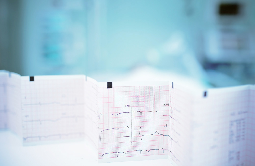 EKG-Auswertung zur Diagnose von Herzrhythmus und Herzklappenproblemen