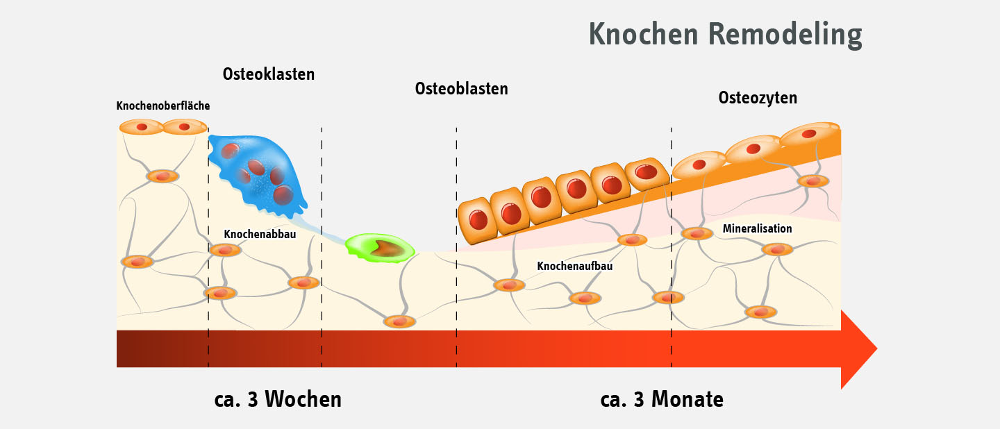 Grafische Darstellung des Knochen-Remodelings: Osteoklasten bauen Knochen in ca. 3 Wochen ab, während Osteoblasten und Osteozyten ihn in ca. 3 Monaten wieder aufbauen. Bei Osteoporose überwiegt der Knochenabbau.