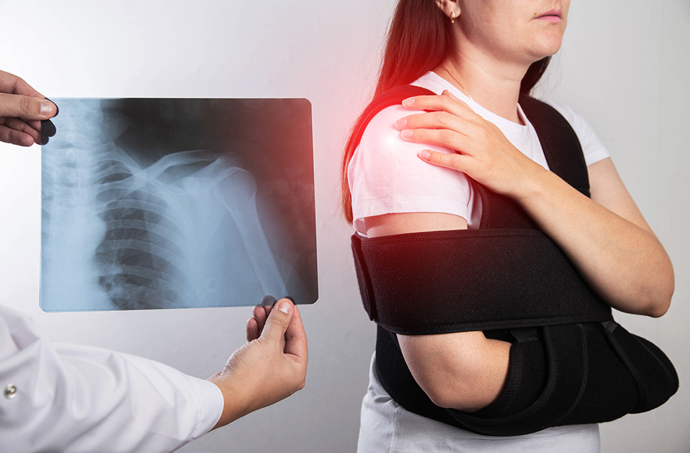 Röntgenbild der Schulter als Diagnostik vor Einsatz einer Schulterprothese
