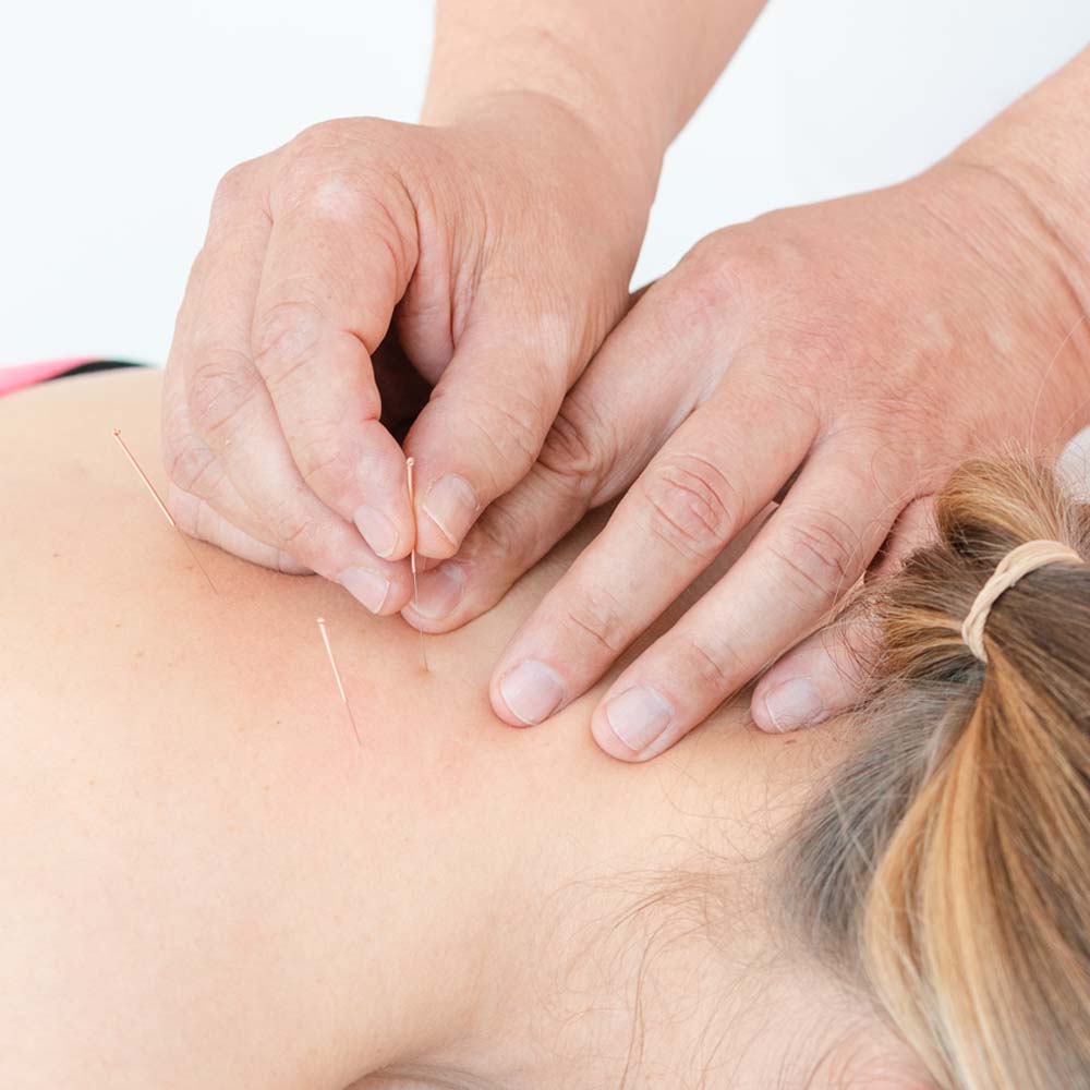 Akupunktur zur Schmerzbehandlung als ergänzende Therapie im ZAR