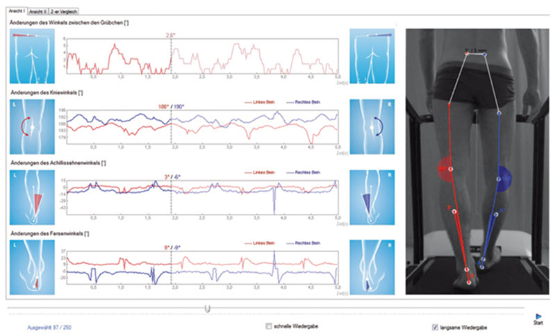 Sportmedizin Gang und Laufanalyse 4d Motion Lab im medicos.AufSchalke - jetzt für Reha & mehr in Gelsenkirchen entscheiden!